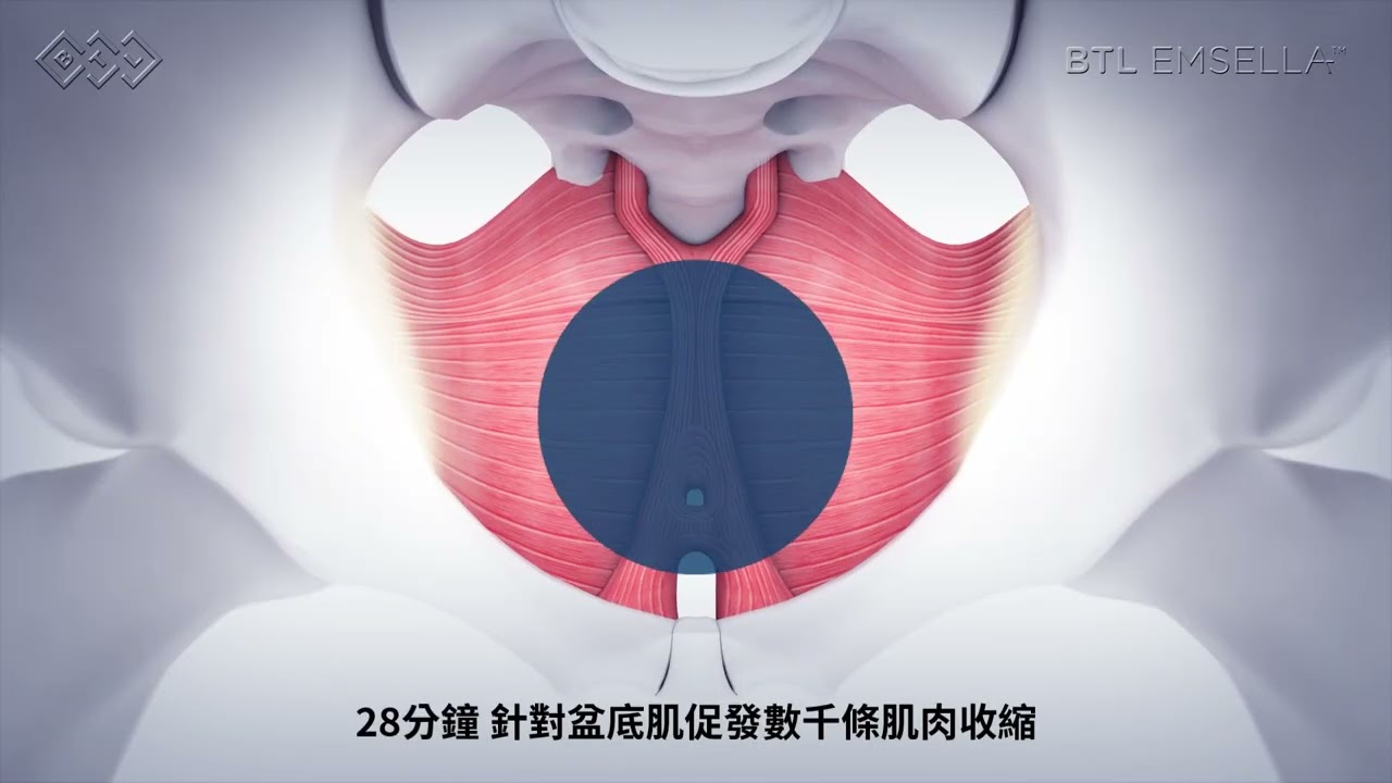 【健康G動椅】28分鐘-讓你揮別擾人的尿意