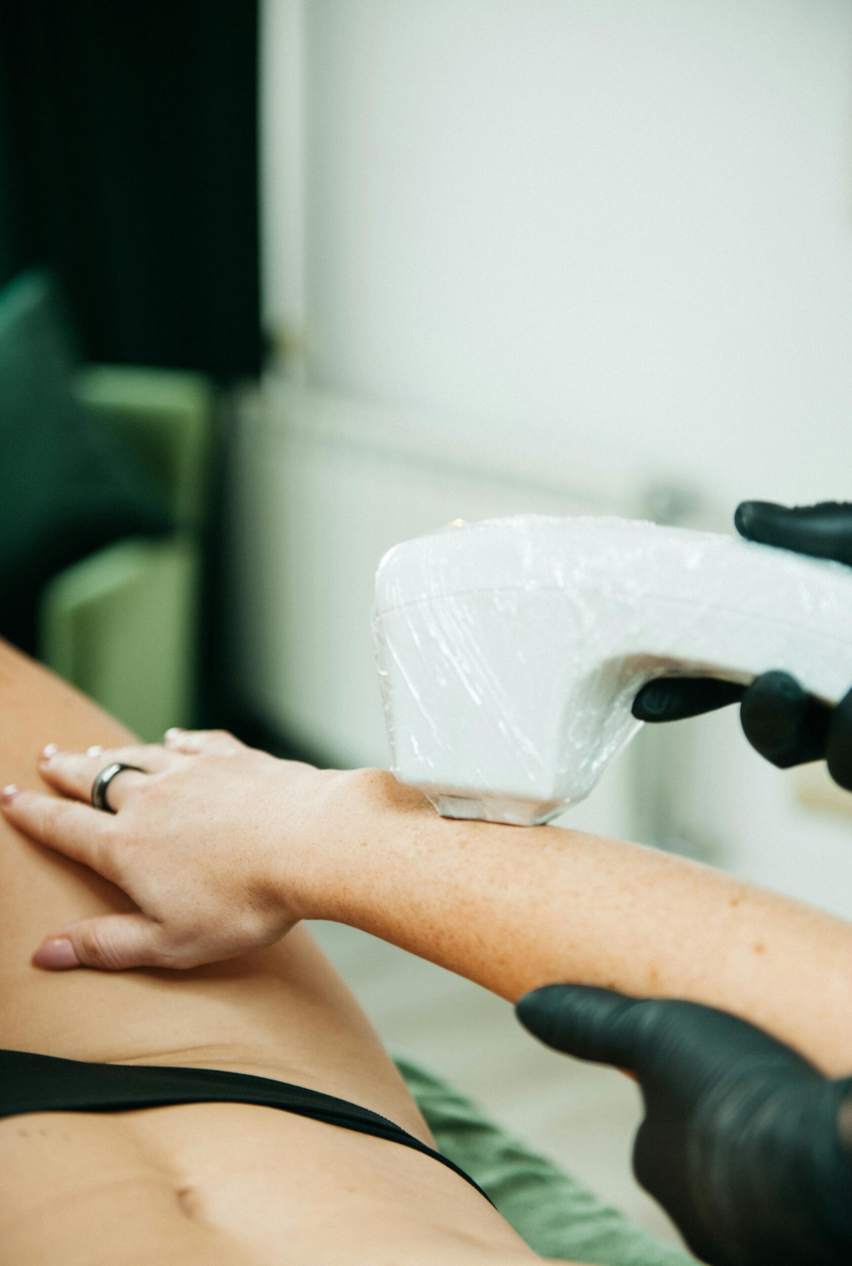 Close-up of laser hair removal treatment on arm, showing device in action.